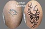 Tattoo cover-up Herz