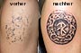 Tattoo cover-up