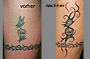Tattoo cover-up